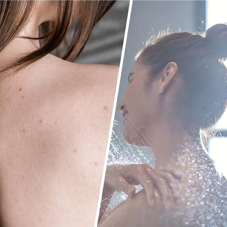 Салицилен скраб с чаено дърво за детоксикация на кожата 250 ml