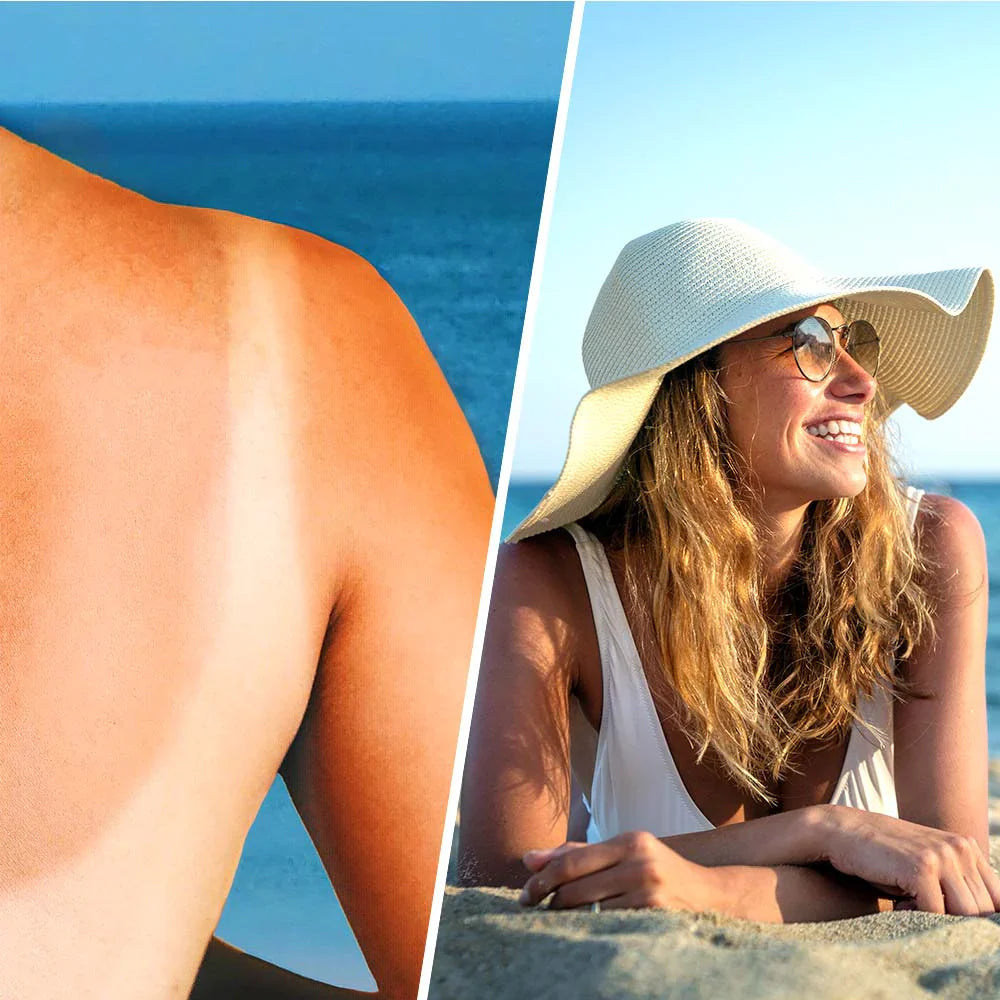 Успокояващ лосион спрей с хиалуронова киселина след слънце - 200 ml