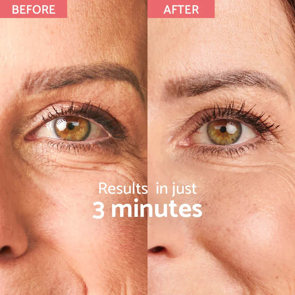 Remescar Instant Wrinkle Corrector - коректор на бръчки с незабавен ефект (180 приложения)
